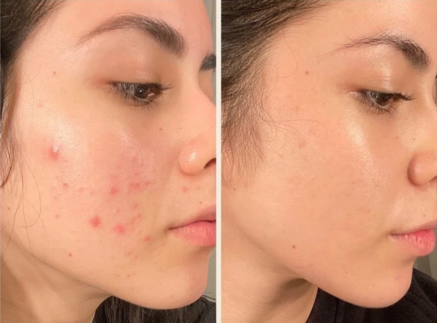 Giải mã tuýp kem chống nắng của Hàn Quốc có tới 5 công dụng bảo vệ da: Chống nắng – Hạ nhiệt – Cấp ẩm – Phục hồi – Tái tạo da